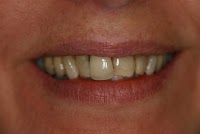 Dental 359 169351 Image 2